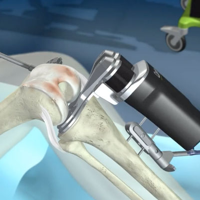 Robotic Assisted Surgery in Queensland